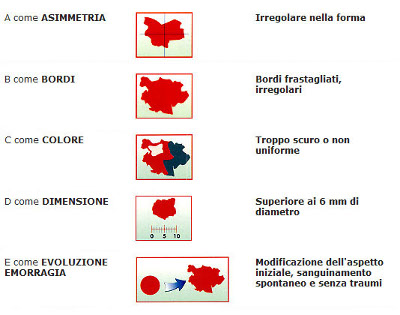 Togliere un basalioma